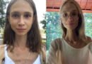 Jovem de 27 anos morre após seguir dieta extrema à base de frutas e chegar aos 22 kg