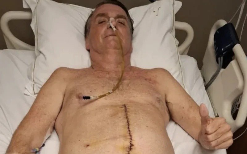 Bolsonaro vai para UTI após febre alta, queda de oxigênio e diagnóstico de pneumonia bacteriana bilateral
